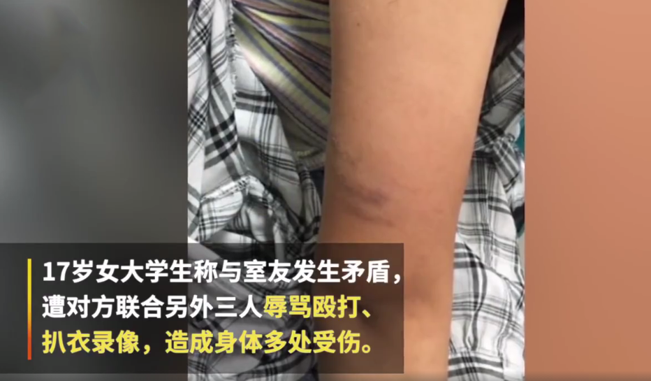17岁女学生被室友扒衣录像专家:让你知道什么是校园暴力