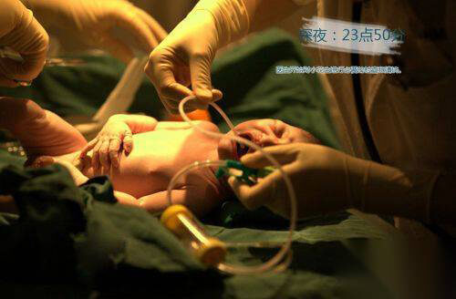 女子分娩全过程图 目击产妇自然分娩全过程 第17张