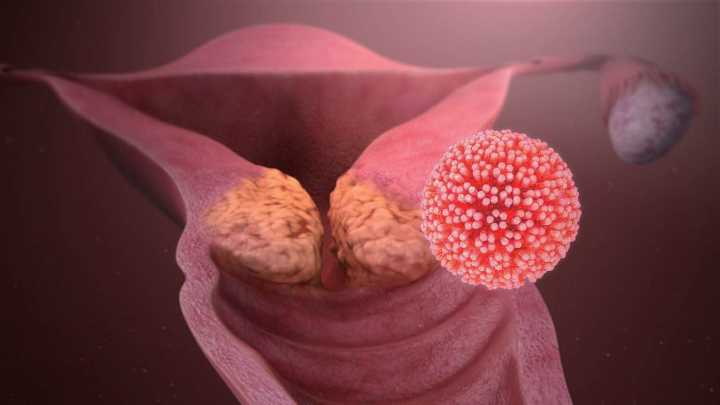图 4–3 HPV 是感染生殖系统的最常见病毒