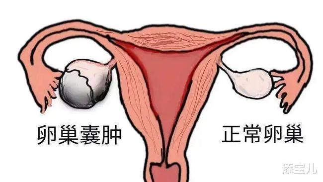 女性子宫和卵巢图片