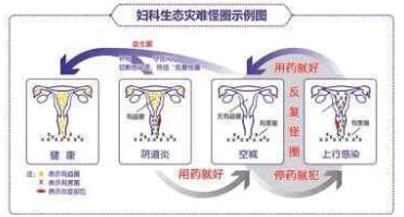 女性拉血是什么回事_引起女性生殖系统炎症的病原体是_女性妇科炎症黄带是怎么回事