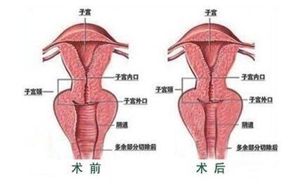 妇科医院引进韩式女性私密整形_妇科医院引进韩式女性私密整形